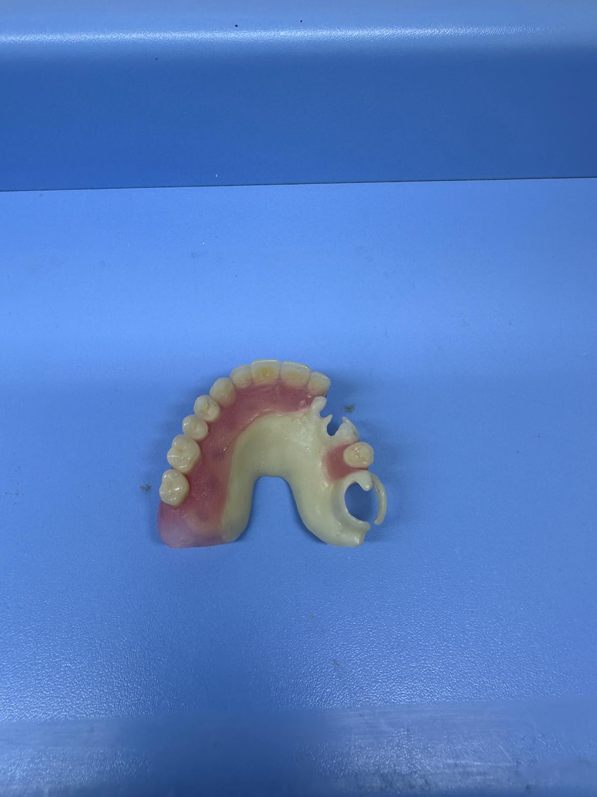 Asetalli Parsiyel Protez