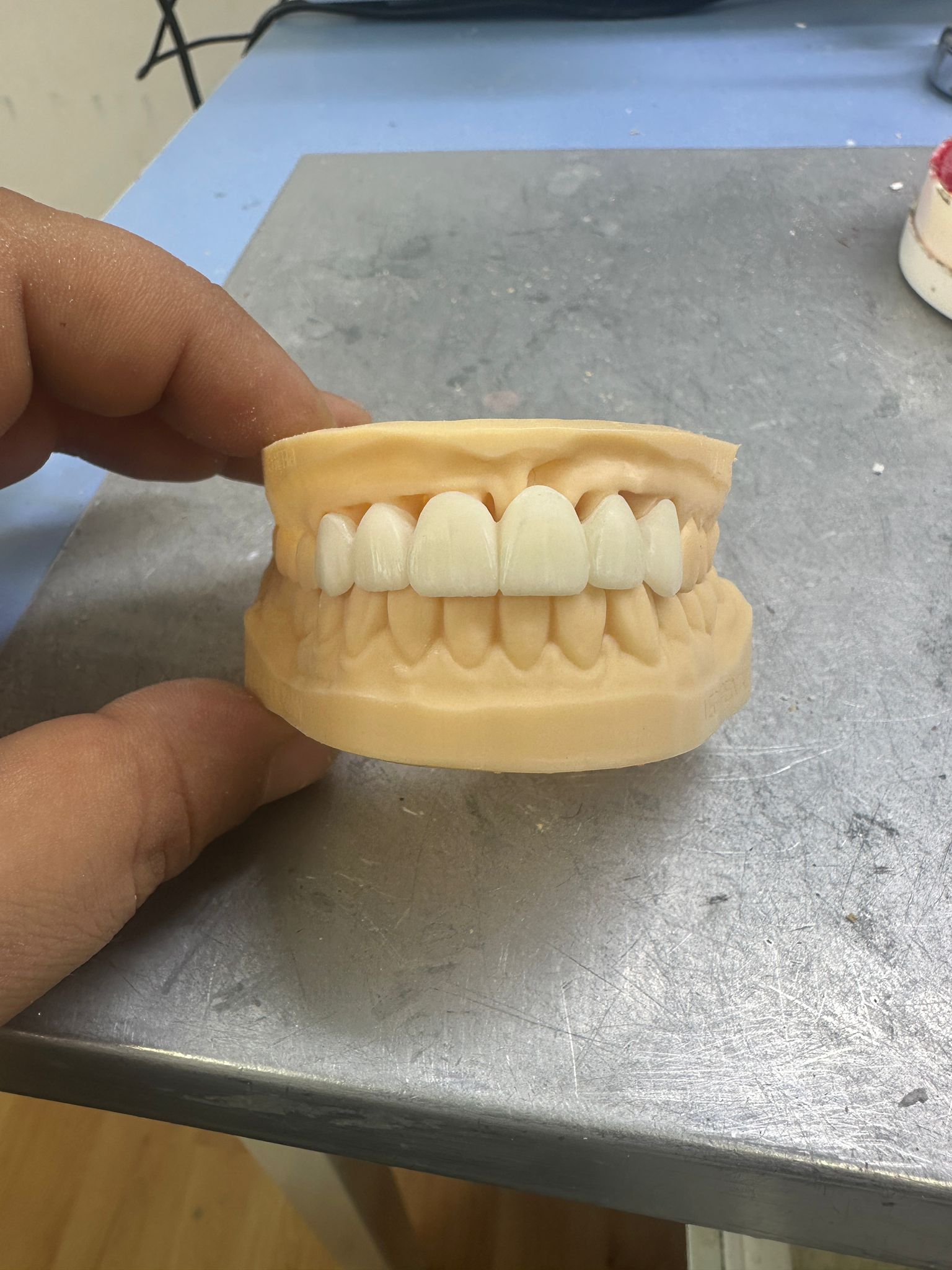 Geçici Restorasyon Uygulaması