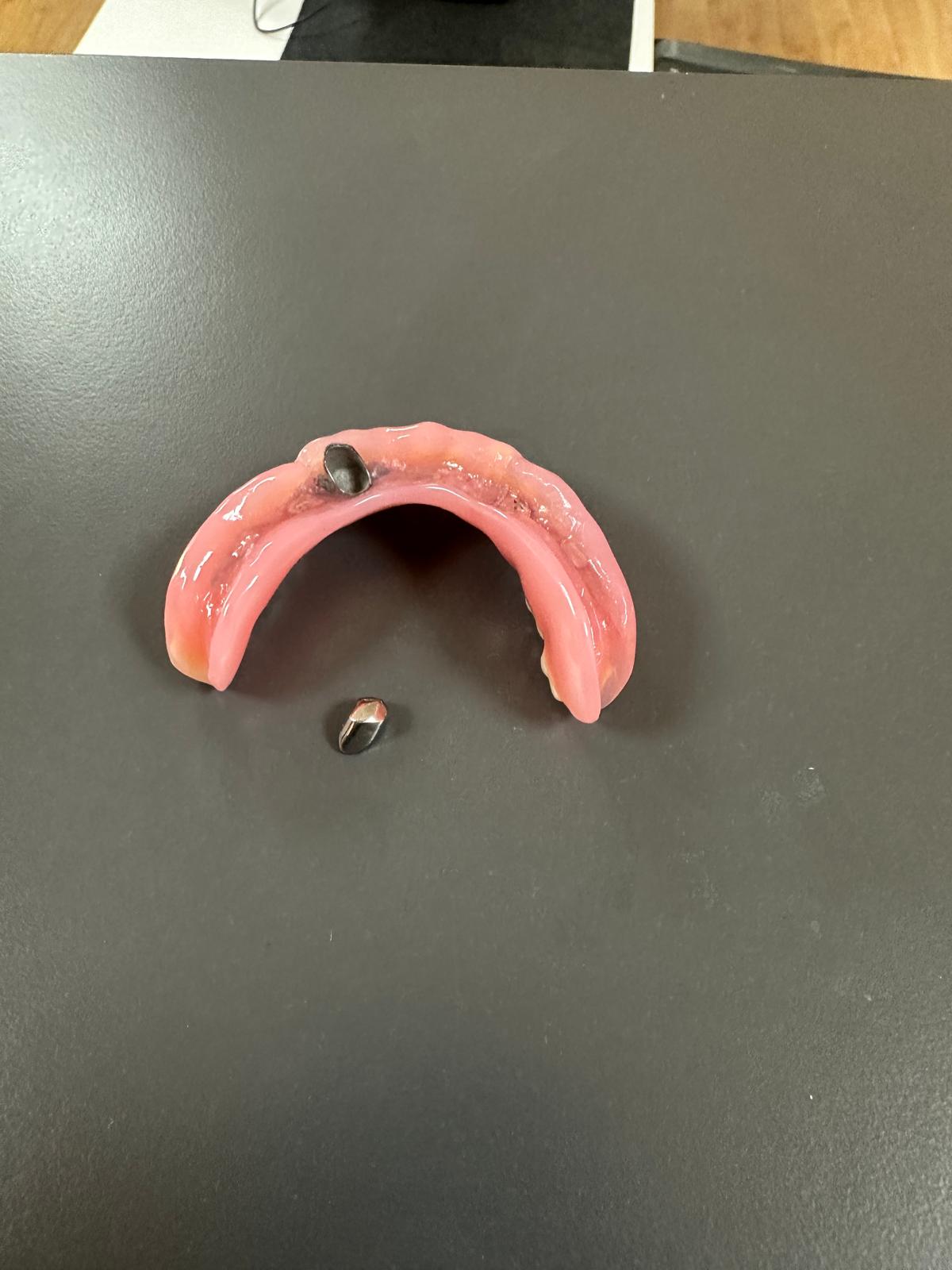 Teleskopik Taç Uygulaması